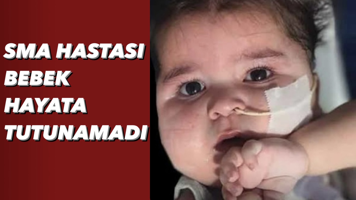 SMA Hastası Bebek Hayata Tutunamadı