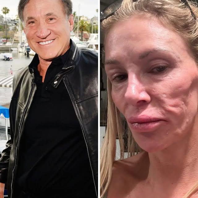 Plastik Cerrah Terry Dubrow, Brandi Glanville'a Yardım Teklif Etti