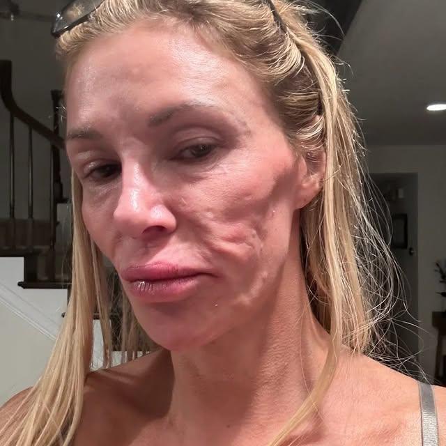 Brandi Glanville'nin Samimi İlişkilerle İlgili Sarsıcı Açıklamaları