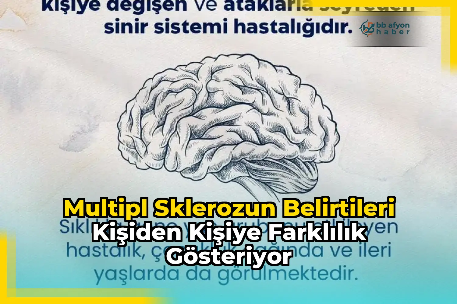 Multipl sklerozun belirtileri kişiden kişiye farklılık gösteriyor